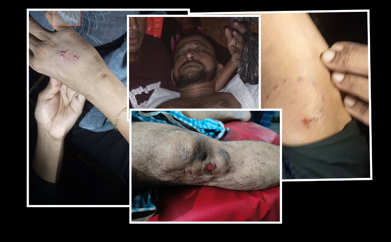 কুতুবদিয়ায় বৃদ্ধা নানীসহ মামা-মামীকে মারধর : থানায় এজাহার