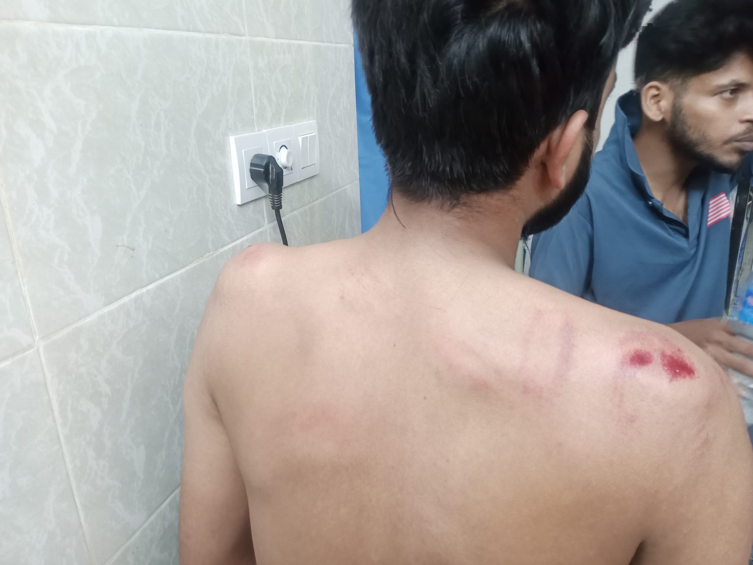 কুতুবদিয়ায় গাঁজা সেবনকে কেন্দ্র করে হামলায় আহত-৩