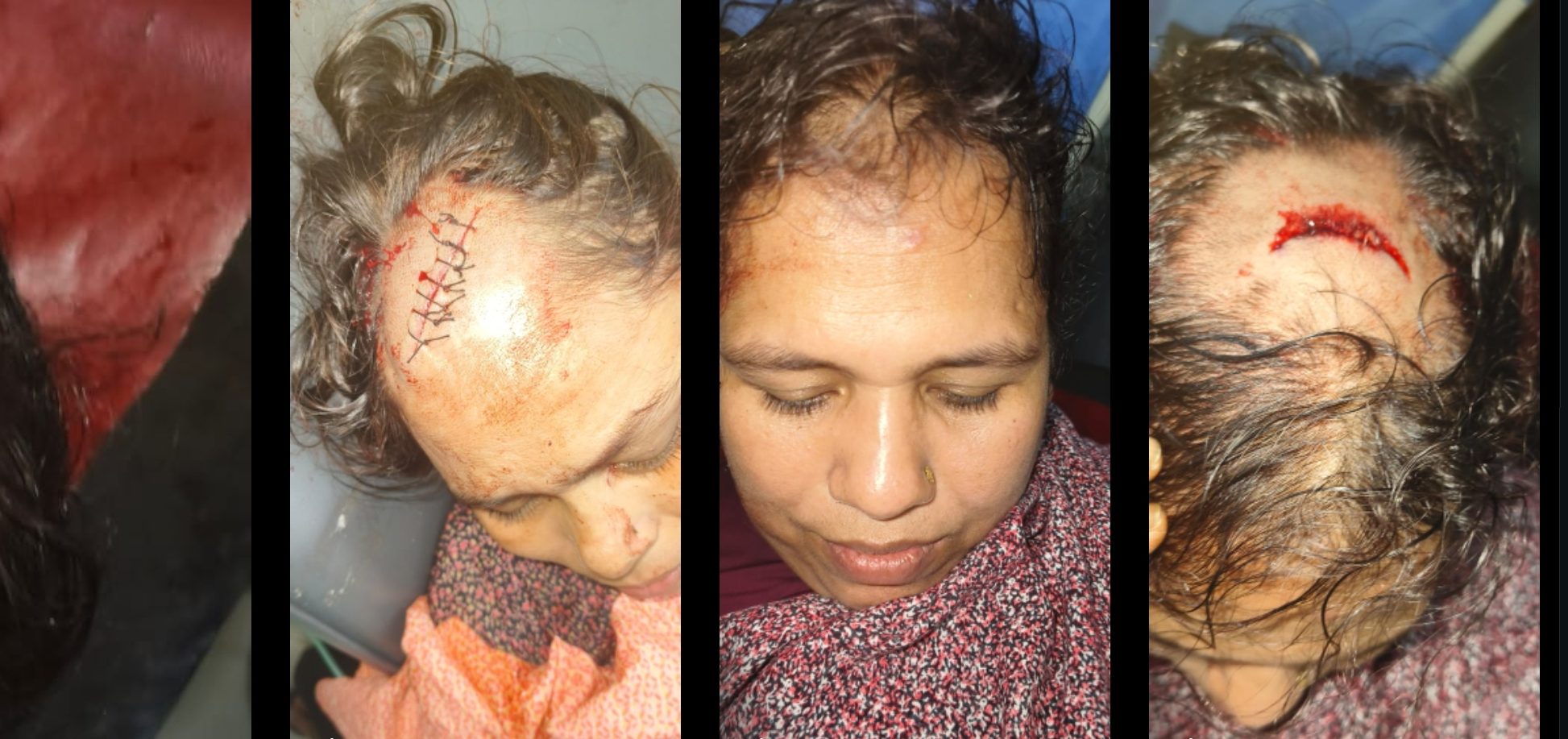 কুতুবদিয়া উপজেলা স্বাস্থ্য কমপ্লেক্সে রোগীর উপর হামলা