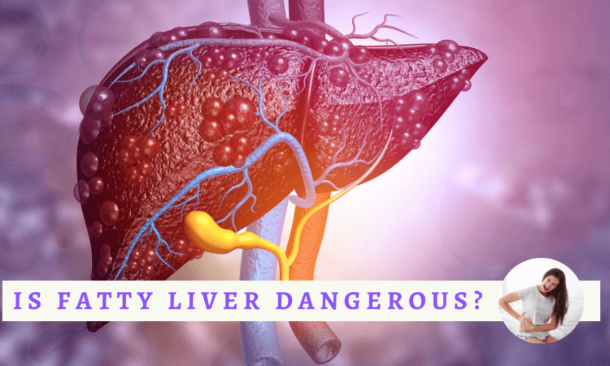 যে খাবারগুলো রোজ খেলে ছুঁতে পারবে না ফ্যাটি লিভার?